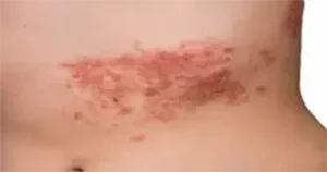 عکس زونای بدن